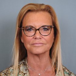 Facelift Before & After Patient #484
