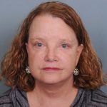 Blepharoplasty Before & After Patient #550