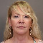 Facelift Before & After Patient #3224