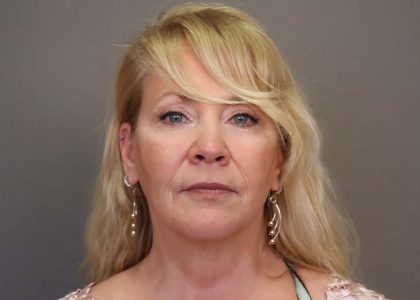 Facelift Before & After Patient #3224