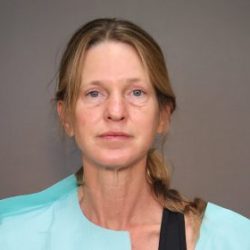 Blepharoplasty Before & After Patient #4539