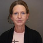 Blepharoplasty Before & After Patient #4539