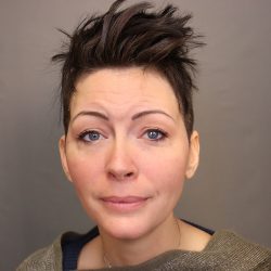 Chin Implants Before & After Patient #3704