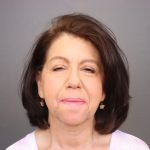 Chin Implants Before & After Patient #3705