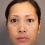 Blepharoplasty Before & After Patient #3595