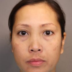 Blepharoplasty Before & After Patient #3595