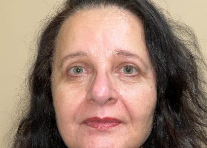 Blepharoplasty Before & After Patient #4521