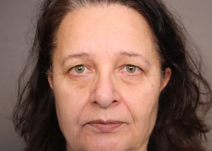 Blepharoplasty Before & After Patient #4521