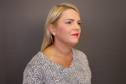 Facelift Before & After Patient #4348