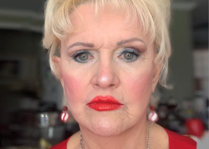 Facelift Before & After Patient #4350