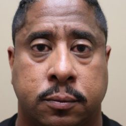 Blepharoplasty Before & After Patient #3591