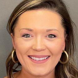 Otoplasty Before & After Patient #3676