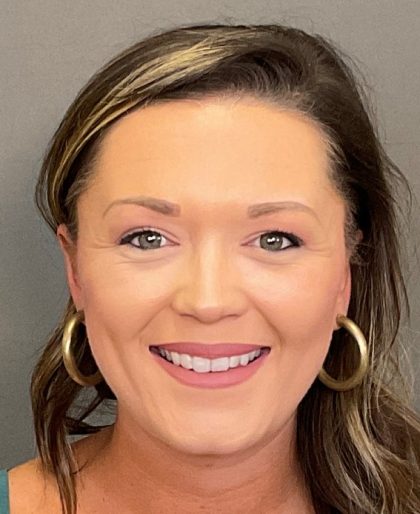 Otoplasty Before & After Patient #3676
