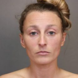 Rhinoplasty Before & After Patient #4443