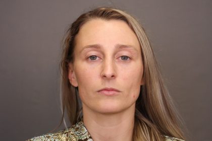 Rhinoplasty Before & After Patient #4443
