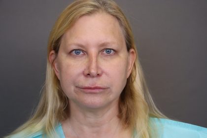 Rhinoplasty Before & After Patient #4442