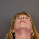 Rhinoplasty Before & After Patient #4441