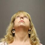 Rhinoplasty Before & After Patient #4441