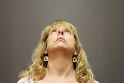 Rhinoplasty Before & After Patient #4441