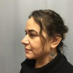 Rhinoplasty Before & After Patient #4440