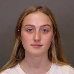 Rhinoplasty Before & After Patient #4437