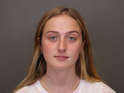 Rhinoplasty Before & After Patient #4437
