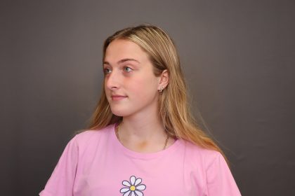 Rhinoplasty Before & After Patient #4437