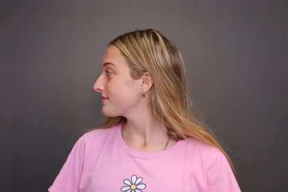 Rhinoplasty Before & After Patient #4437