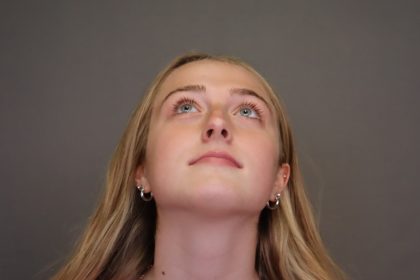 Rhinoplasty Before & After Patient #4437